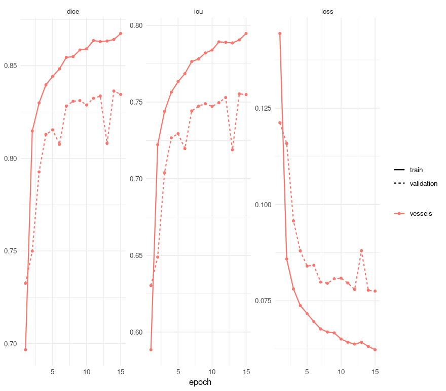 Dice and loss per epoch, training and validation
