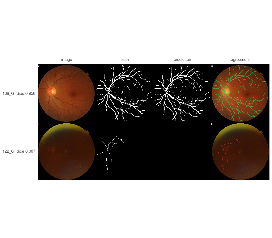 The best and the worst validation case: image, truth and prediction